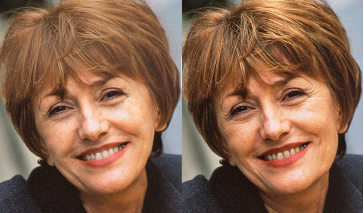 Gesichtsfotos vor und nach der Konturierung